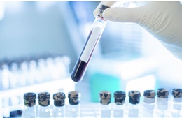 Nghiên cứu phương pháp xét nghiệm máu phát hiện sớm đa ung thư