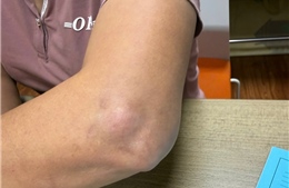 Cảnh báo mạo danh bác sĩ Bệnh viện Bạch Mai ở phòng khám tư 