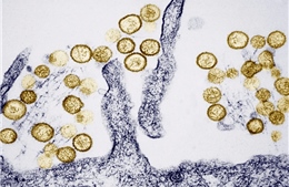 Bộ Y tế thông tin chính thức về bệnh do virus Hanta