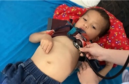 Bốn trẻ nhỏ tại Tuyên Quang bị ngộ độc do ăn thịt cóc