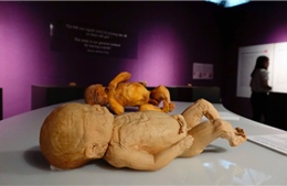 Bộ Văn hóa yêu cầu giải trình triển lãm dùng bộ phận cơ thể người thật