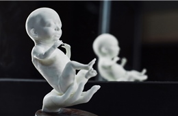 Startup: Mốt tạo hình 3D &#39;thiên thần&#39; trong bụng mẹ