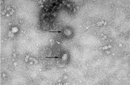 Hàn Quốc phát hiện trường hợp đầu tiên nhiễm virus corona