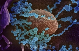 Các nhà khoa học Argentina chụp được ảnh virus SARS-CoV-2 lây nhiễm trong nước