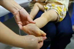 Số người trên 15 tuổi mắc sốt xuất huyết ở Đồng Nai chiếm tỷ lệ cao