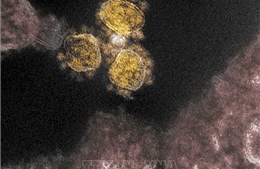 Người nhiễm biến thể Delta có tải lượng virus cao gấp 300 lần so với nhiễm virus SARS-CoV-2 gốc
