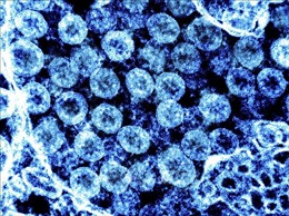 Thông tin sâu hơn về các biến thể tái tổ hợp của virus SARS-CoV-2