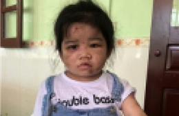 Hà Tĩnh: Bé gái 4 tuổi ở thị trấn Thiên Cầm bị dì ruột bạo hành