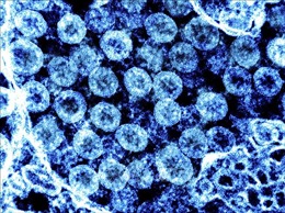 Israel: Biến thể BA.2.86 của virus SARS-CoV-2 có tới hơn 30 đột biến mới