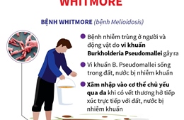 Bệnh truyền nhiễm nguy hiểm Whitmore: Những điều cần biết