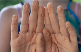 Phát hiện bất ngờ về hiện tượng ngón tay nhăn nheo khi ngâm nước