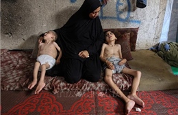 Xung đột Hamas - Israel: WHO cảnh báo suy dinh dưỡng tại Gaza ở mức &#39;báo động&#39;
