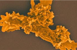 Phát hiện loài sinh vật mới sống sót ở nhiệt độ cao kỷ lục 