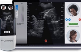 Thiết bị cầm tay giúp thai phụ tự thực hiện siêu âm tại nhà