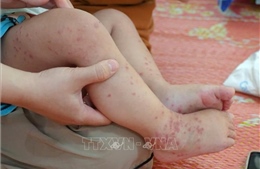 TP Hồ Chí Minh ghi nhận 3 ca tử vong do tay chân miệng đầu tiên của năm 2026