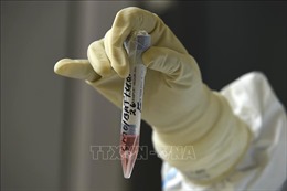 Algeria bắt đầu sản xuất bộ dụng cụ xét nghiệm virus SARS-CoV-2