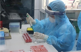 Các trường hợp F1 tại Bình Định có kết quả âm tính lần 1 với SARS-CoV-2