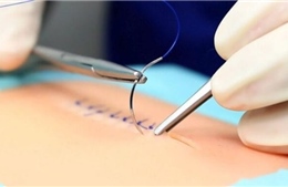 Đột phá phẫu thuật an toàn nhờ nút thắt &#39;lập trình sẵn&#39;