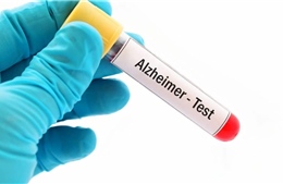 Bộ xét nghiệm máu mới giúp phát hiện sớm bệnh Alzheimer