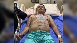 Nấc khó hiểu 10 ngày không ngừng, Tổng thống Brazil phải nhập viện