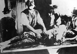 Những thí nghiệm trên người tàn bạo nhất của phát xít Nhật thời Thế chiến II - Phần 1