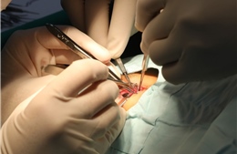 Tặng nụ cười, sự tự tin cho trẻ em bị khiếm khuyết ở vùng sâu, vùng xa