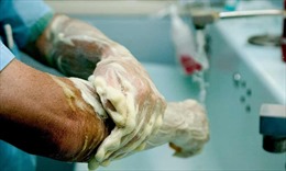 Lịch sử 130 năm đầy kinh ngạc về rửa tay sát khuẩn