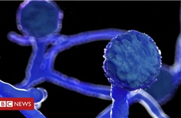 Mexico có ca tử vong đầu tiên do nhiễm trùng ‘nấm đen’