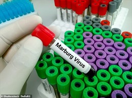 Nâng cao cảnh giác với bệnh do virus Marburg​