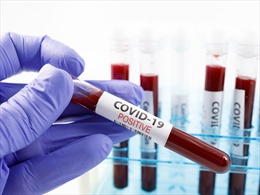 80% người mắc COVID-19 ở Thụy Điển vẫn còn kháng thể sau 1 năm
