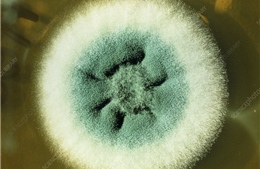 Loại nấm ‘rình rập’ bệnh nhân COVID-19, có thể đã giết chết hàng ngàn người