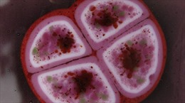 Vi khuẩn ‘cứng đầu’ nhất thế giới, chống lại cả phóng xạ