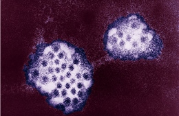 Dịch cúm dạ dày bùng phát tại Mỹ sau làn sóng COVID-19