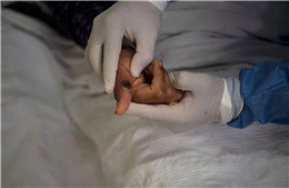 Mexico thông báo ca tử vong đầu tiên dương tính với virus gây bệnh đậu mùa khỉ