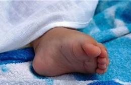 Em bé sinh ra không có mặt, bác sĩ Bồ Đào Nha bị đình chỉ công tác