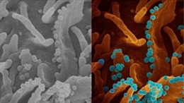 Hình ảnh tế bào virus SARS-CoV-2 sắp chết giải phóng các hạt virus mới