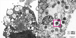 Công bố hình ảnh đầu tiên về biến thể Omicron dưới kính hiển vi điện tử