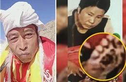 Người đàn ông nhốt vợ trong lồng sắt gây phẫn nộ tại Trung Quốc