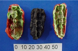 &#39;Kẹo cao su&#39; 10.000 năm tuổi tiết lộ sức khoẻ răng miệng của cư dân thời đồ đá