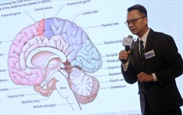 Trung tâm nghiên cứu Hong Kong (Trung Quốc) ra mắt AI hỗ trợ phẫu thuật não