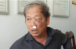 Đã xác định được đối tượng hành hung nhà báo tại Kon Tum 