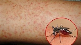 Trường hợp đầu tiên tử vong do sốt xuất huyết tại Đồng Nai