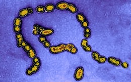 Anh cảnh báo về tình trạng nhiễm liên cầu khuẩn khiến 6 trẻ em tử vong