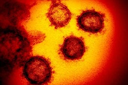 Anh: Phát hiện trường hợp đầu tiên nhiễm cúm lợn ở người