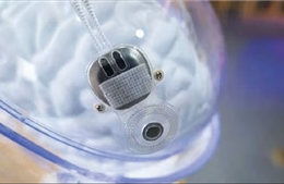 Trung Quốc cấp phép lưu hành đối với thiết bị y tế BMI xâm lấn