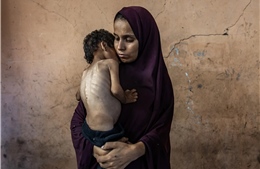 Loạt ảnh chiến sự tại Gaza giành giải thưởng Pulitzer