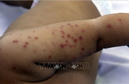 Thành phố Hồ Chí Minh: Bệnh sốt xuất huyết ở mức cao, bệnh tay chân miệng vào mùa