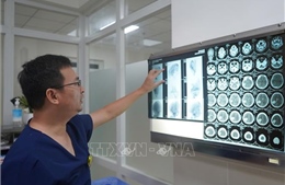 Cứu sống bệnh nhi xuất huyết não ở trẻ do dị dạng mạch máu 