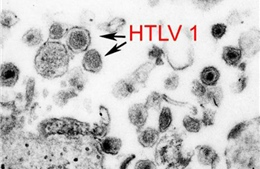 Nghiên cứu dùng virus bạch cầu để điều trị HIV