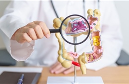Phát triển máy in sinh học siêu nhỏ có thể chữa lành loét dạ dày